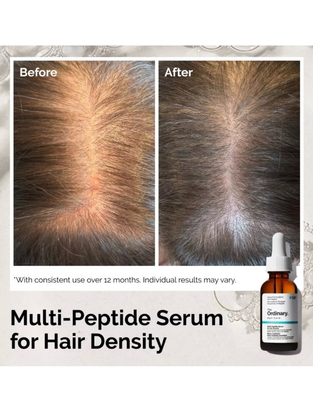 The Ordinary Multi-Peptide Serum for Hair Density - Picture 5 of 10